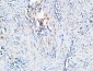 TGFβ1 Polyclonal Antibody